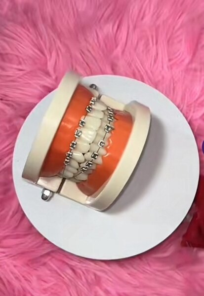 Fashion braces