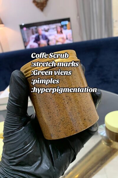 Stretch marks soap
