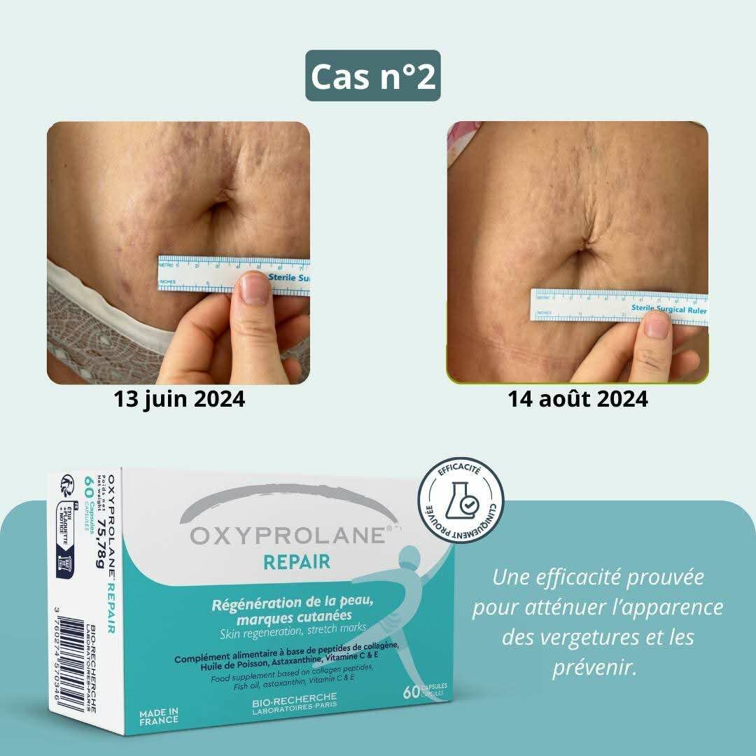 OXYPROLANE REPAIR
