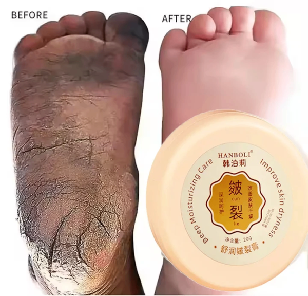 Baume Réparatrice pour pieds