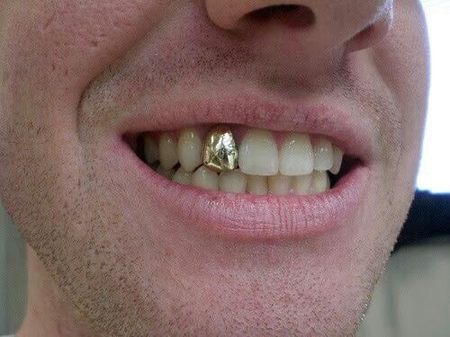 Grills