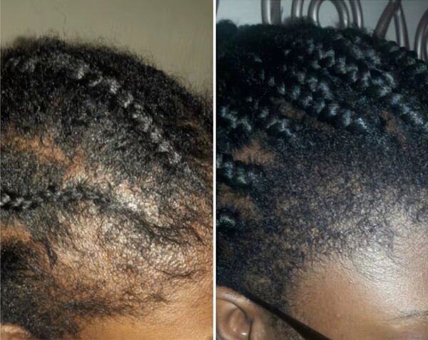 Huile de cheveux