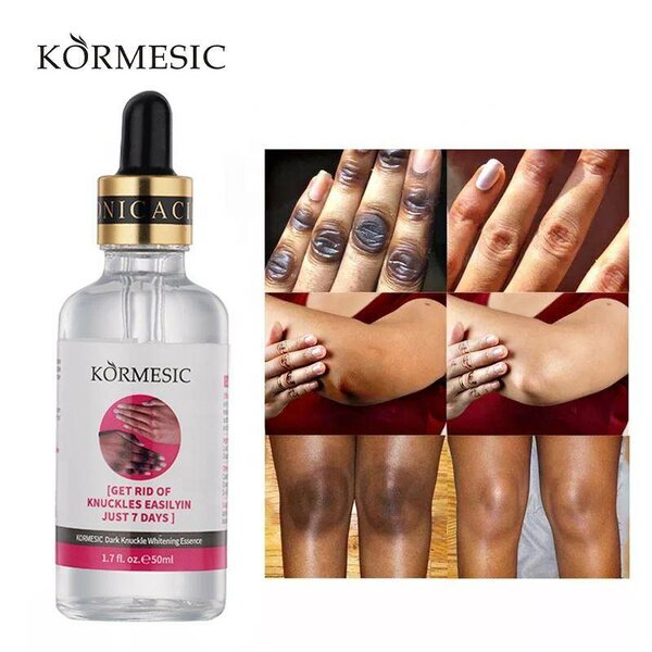 KORMESIC