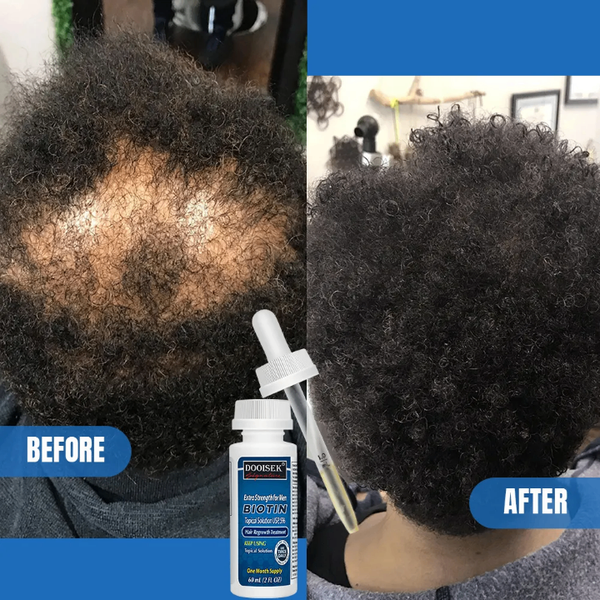 Minoxidil kirkland