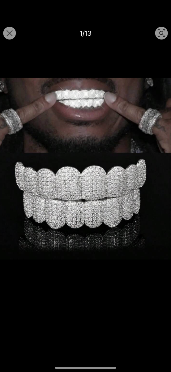Grillz dentaires