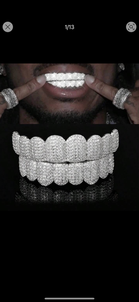 Grillz dentaires