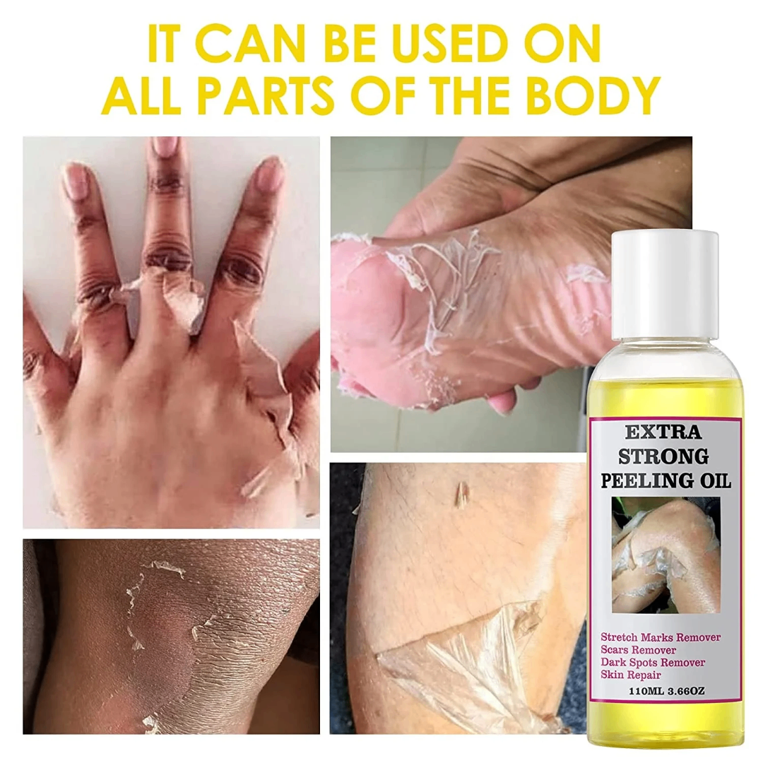 Huile Peeling Forte Corps