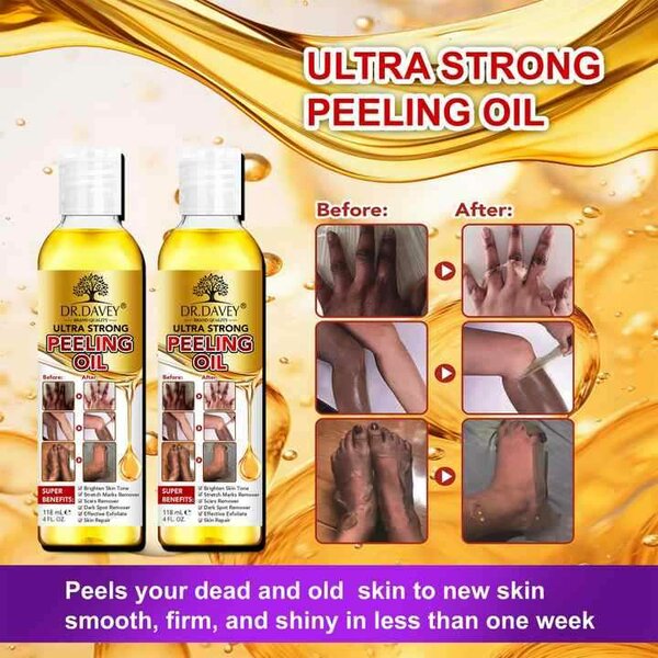 Dr. Davey ultra strong peeling oil