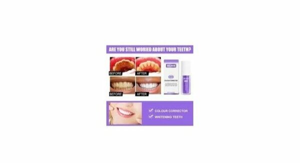 Smilekit Correcteur de Dents