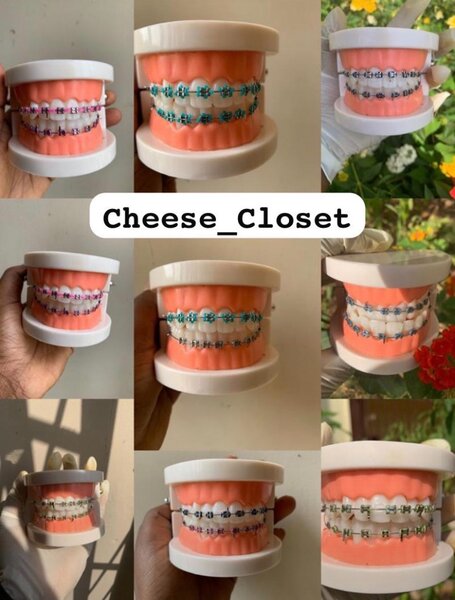 Fashionable Braces
