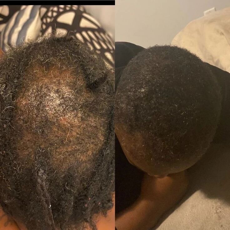 Hair Growth Oil