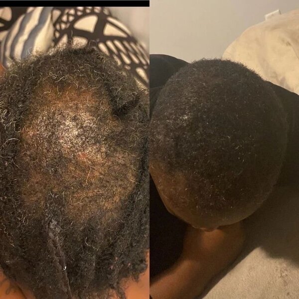Hair Growth Oil