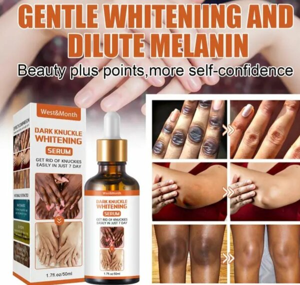 Dark knuckle whitening serum