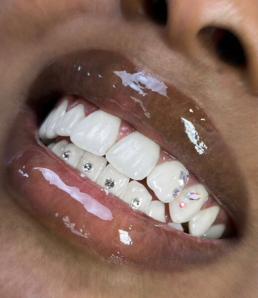 Teeth Gem