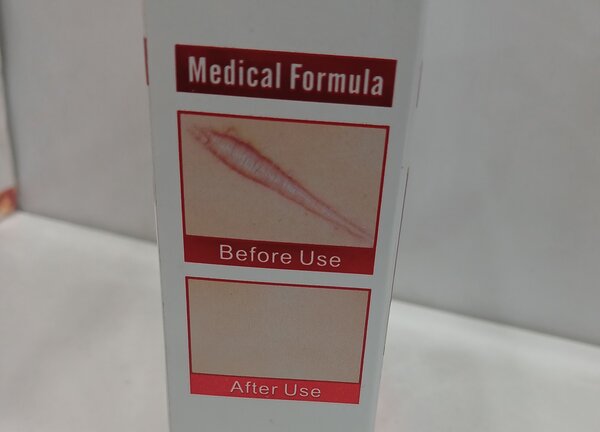 Anti wrinkle
