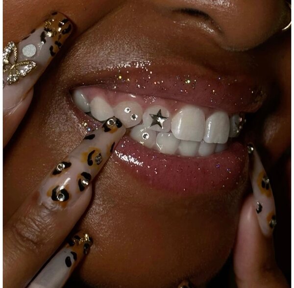 Tooth gems