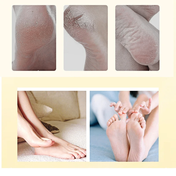 Baume Réparatrice pour pieds