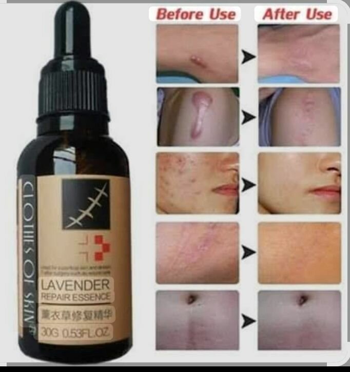 Essence réparatrice lavande cicatrices