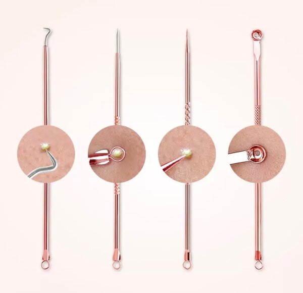 Pimple/Blackhead extractor