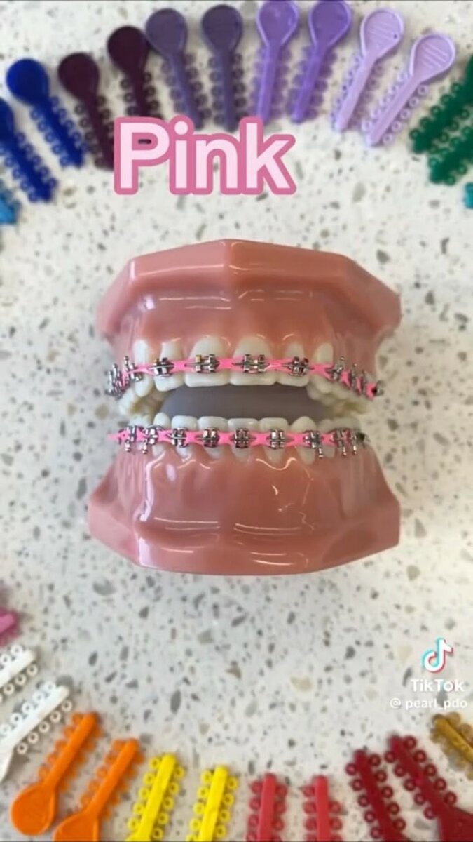Braces