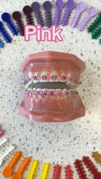 Braces