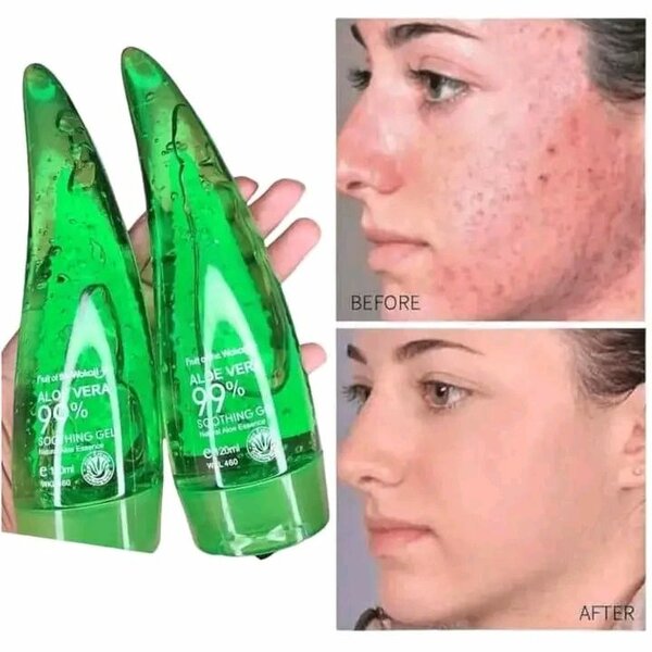 Gel aloe Vera