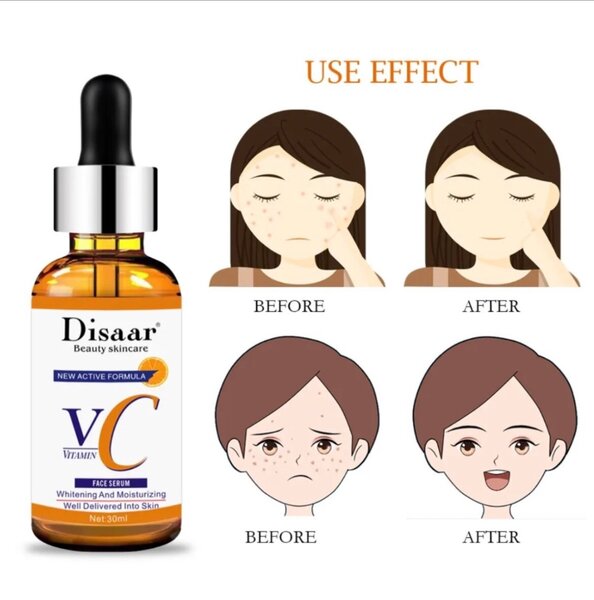 Vitamine C Disaar