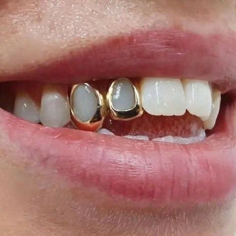 Grill