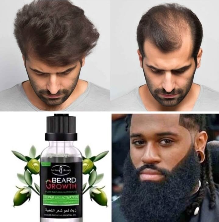 Fait poussé les cheveux, la Barbe en 3 semaine