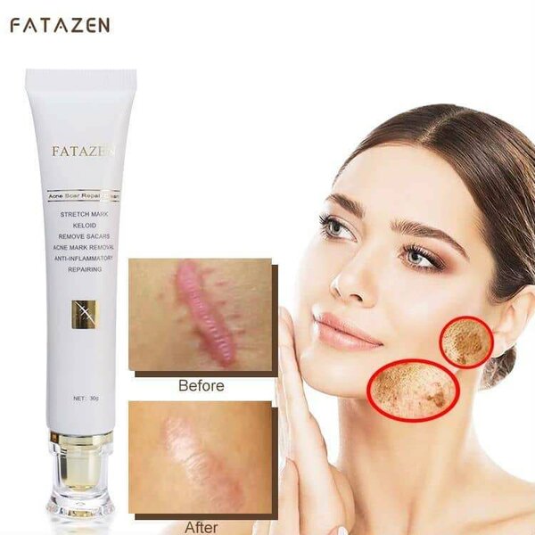 Crèmes anti cicatrice