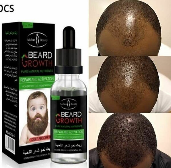 𝗙𝗶𝗻𝗶 𝗮𝘃𝗲𝗰 𝗹𝗮 𝗰𝗮𝗹𝘃𝗶𝘁𝗶𝗲 fait poussé la barbe