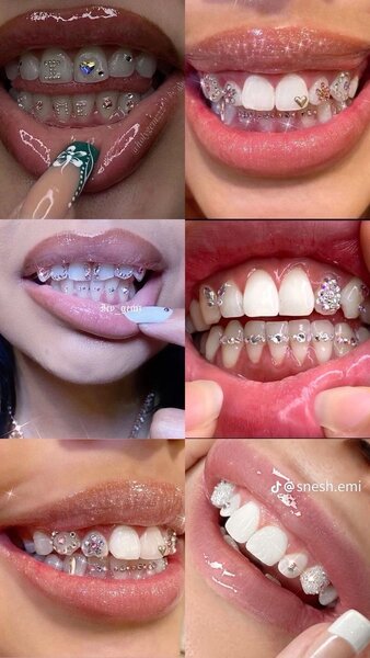 Tooth  gems