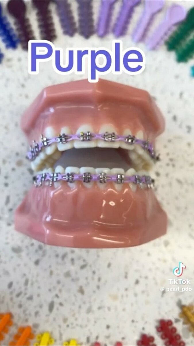 Élastiques orthodontiques colorés