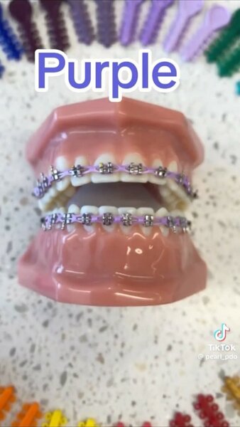 Élastiques orthodontiques colorés