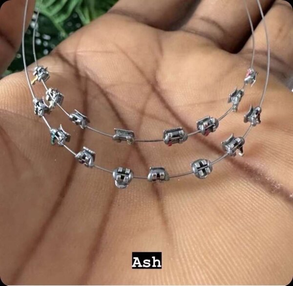 Fashion braces