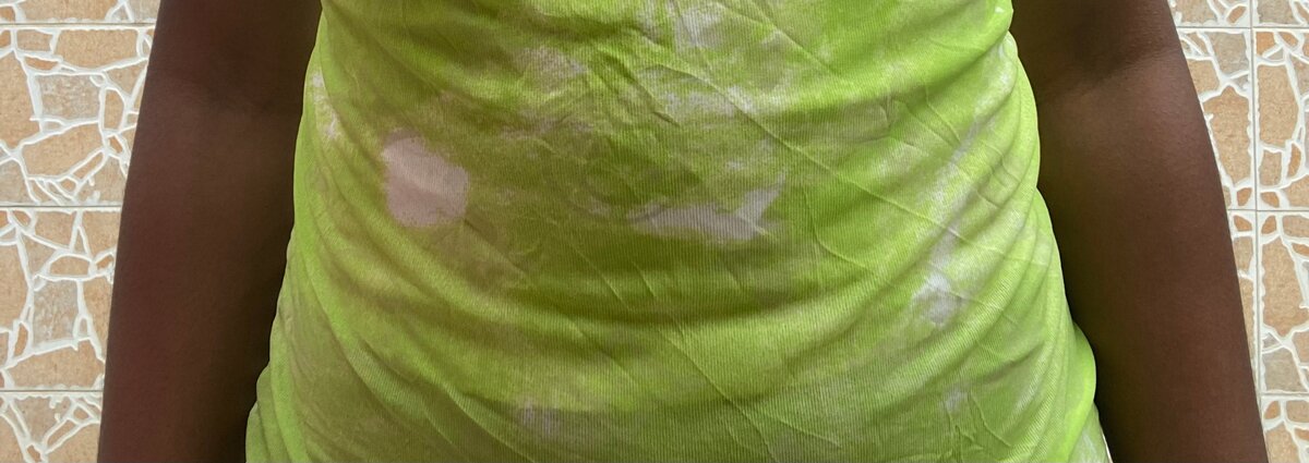 Robe d'été jaune fluo