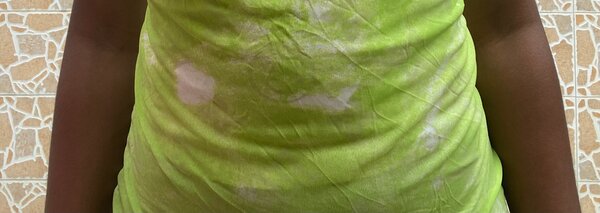 Robe d'été jaune fluo