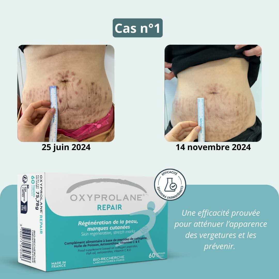 OXYPROLANE REPAIR