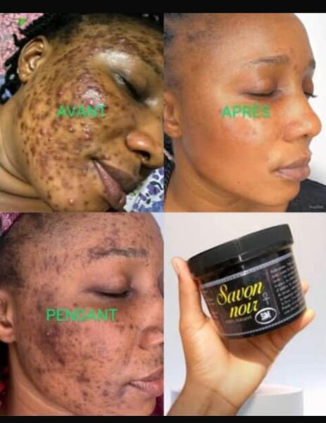 Savon Noir