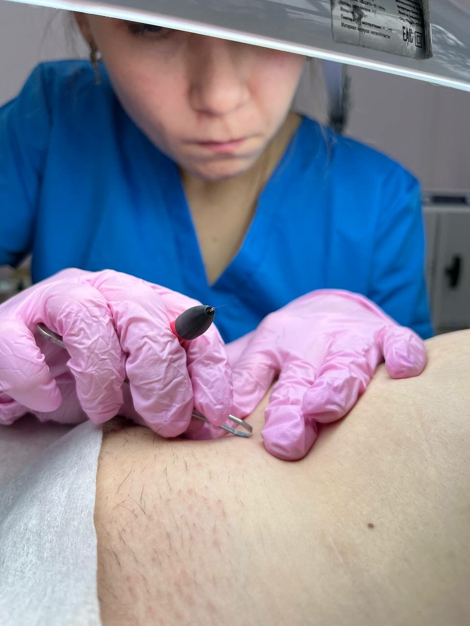 электроэпиляция, студия тату, электроэпиляция аппарат, аппарат электроэпиляции, электроэпиляция в москве