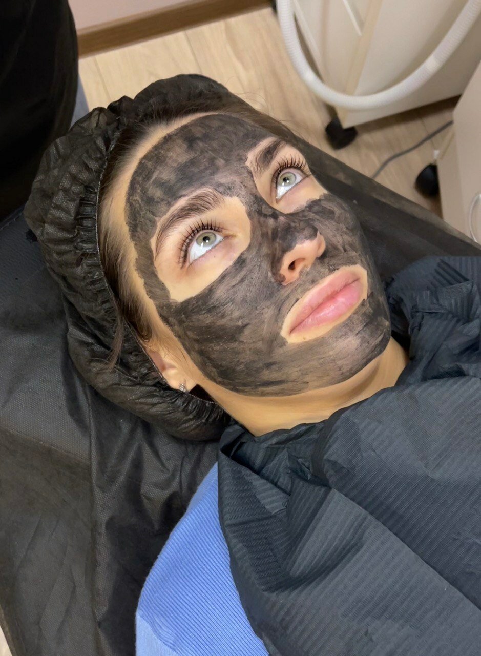 пилинг, пилинг лица, карбоновый пилинг, девушка, процедуры для лица