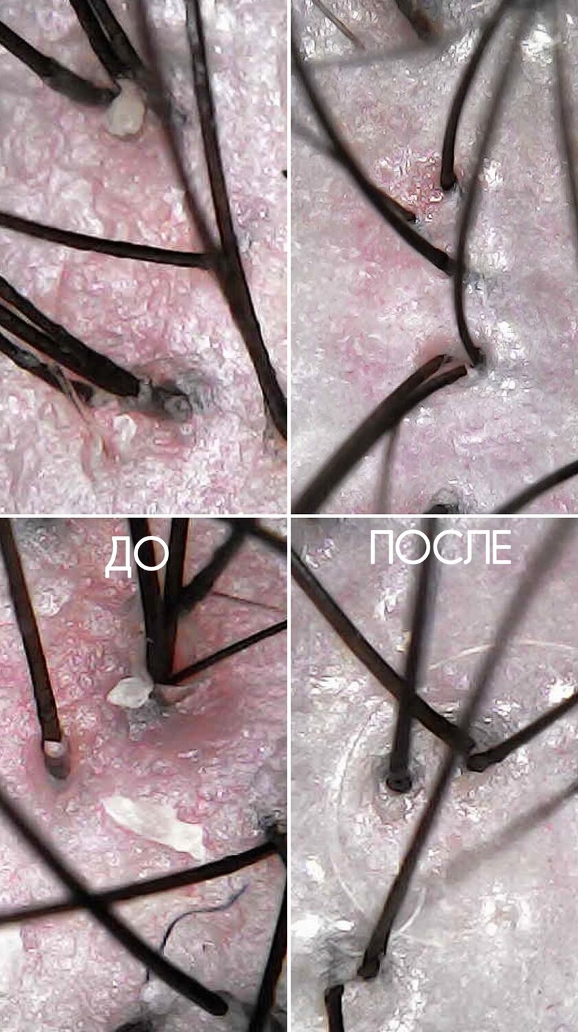 �������� ������������ ������ ����������������������, ���������� ������ ����������������������, �������������� ������ ����������������������, ������������ �� ���������������� ������ ����������������������, �������������� ������ ���������������������� �� ������������