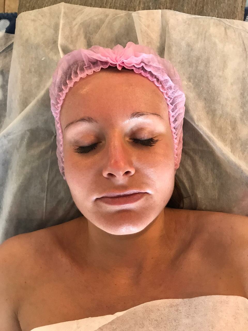 пилинг, пилинг лица, мария кожевникова selfie, макияж мезотерапия, лицо