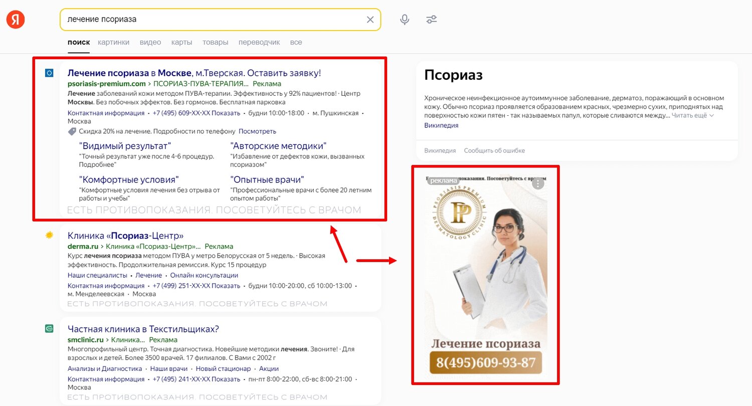 контекстная реклама, пример контекстной рекламы, что такое яндекс, контекстная реклама яндекс директ, виды контекстной рекламы