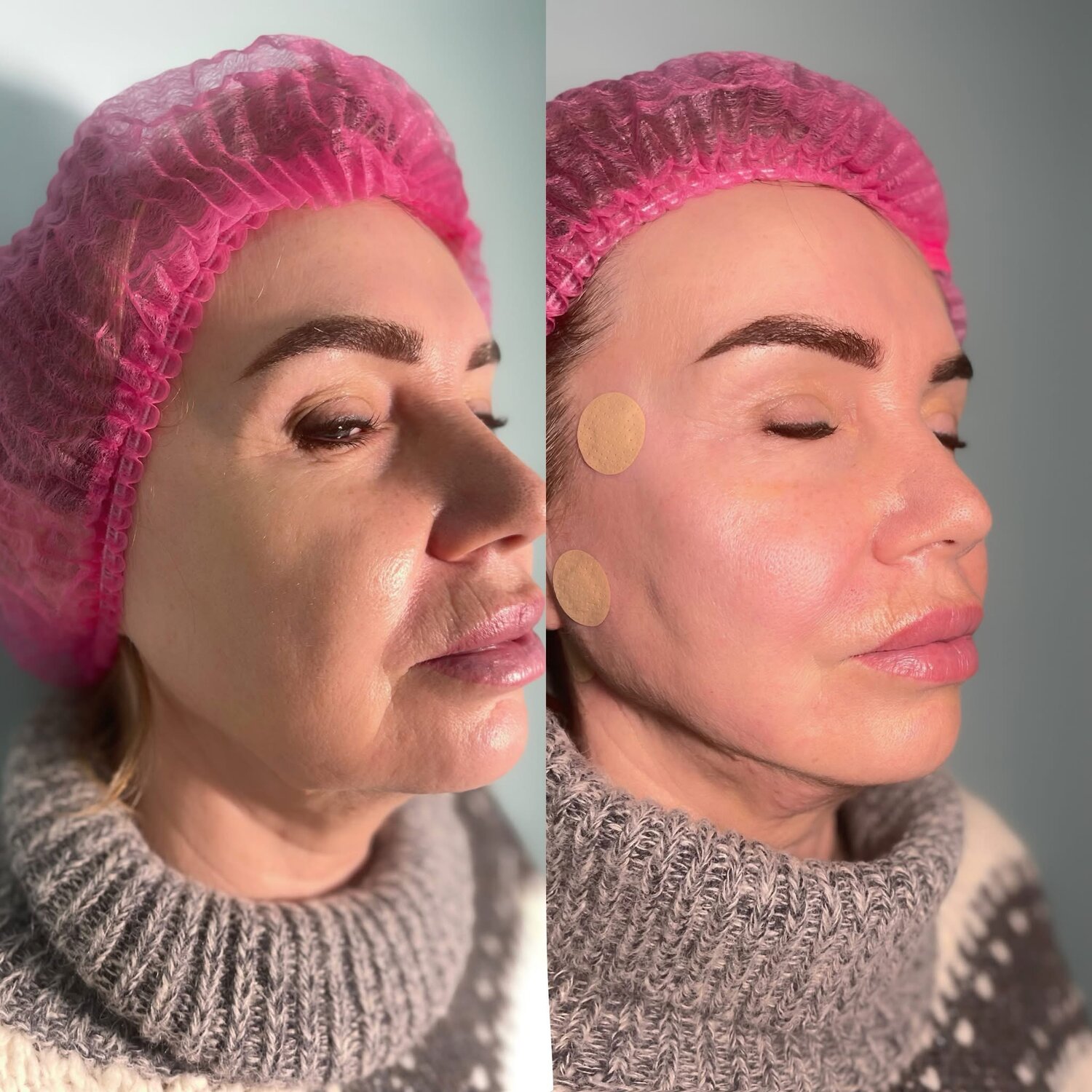 �������������� �������������� ��������, �������������� ��������, �������������� ��������������, ���������������� ��������, �������� �� ������������������������