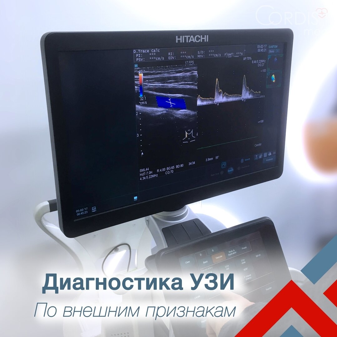3л узи, edv узи, монитор узи, узи, узи 3д mindray