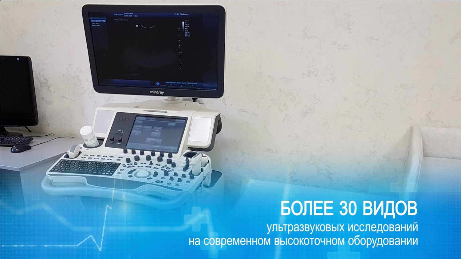 центр ультразвуковой диагностики, ультразвуковое исследование, ультразвуковая диагностика, узи, узи аппарат вивид 8