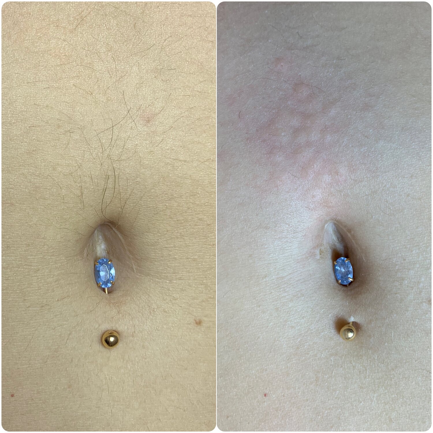 пирсинг пупка, пирсинг, пупок, пирсинг виды, двойной пирсинг пупка