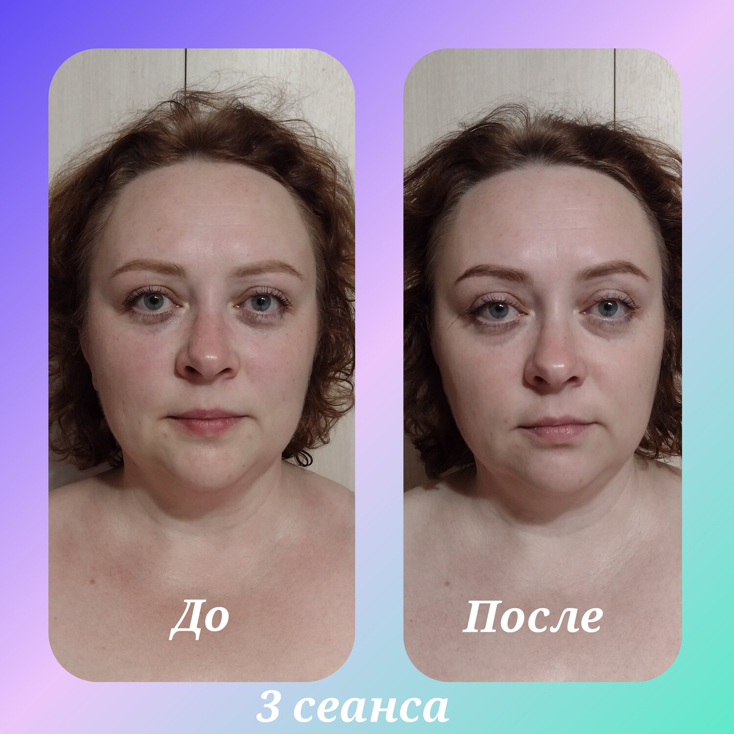 до и после массажа лица, массаж гуаша до и после лицо, после, хиромассаж лица до и после, девушка
