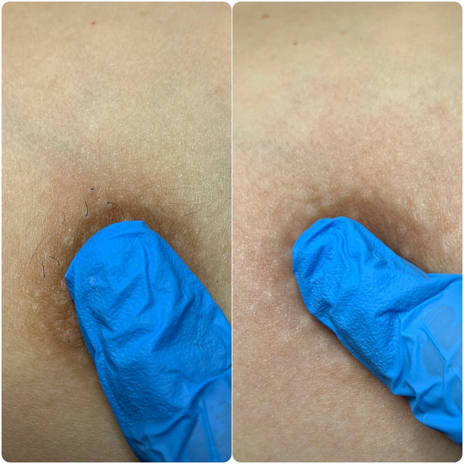 восковая депиляция, депиляция, сахарная депиляция, эпиляция, шугаринг депиляция